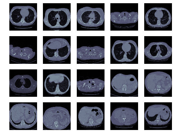anokas looks across a number of patient images